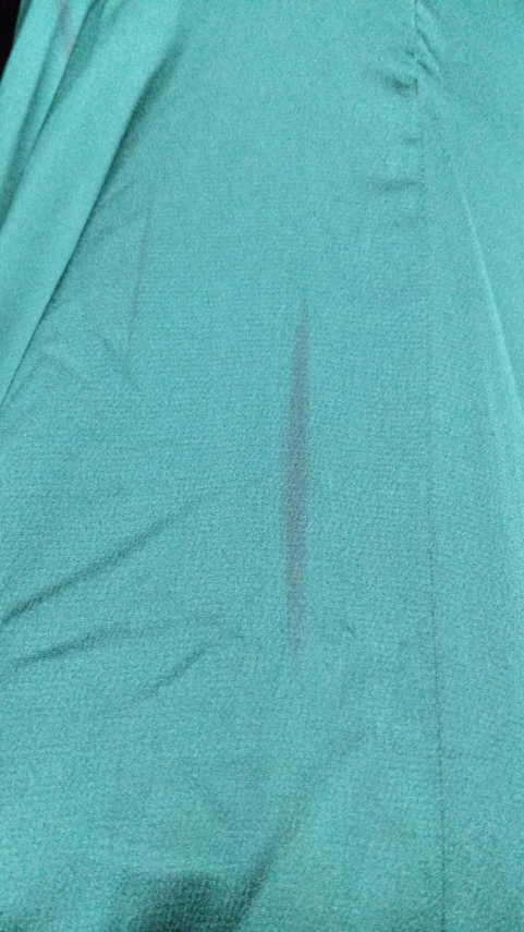 Fırsat Ürünü - Karolina Elbise - Lekeli / Etek Boy Farkı - 2