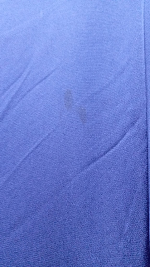 Fırsat Ürünü - Karolina Elbise - Lekeli / Etek Boy Farkı - 15