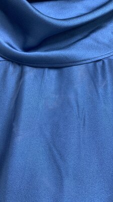 FIRSAT ÜRÜNÜ - Masal Elbise - Lekeli - 3